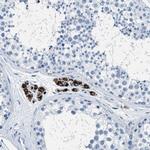 MGARP Antibody in Immunohistochemistry (IHC)
