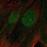 PHF11 Polyclonal Antibody