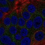 TOB2 Polyclonal Antibody