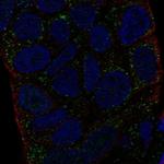 HLA-DMA Polyclonal Antibody