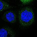 LRCH3 Polyclonal Antibody