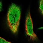 TMEM51 Polyclonal Antibody