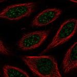 TAIP12 Polyclonal Antibody