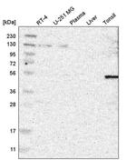 TAIP12 Antibody in Western Blot (WB)