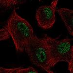 ZIP11 Polyclonal Antibody