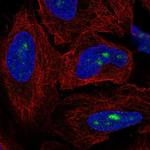 ZNF286A Polyclonal Antibody