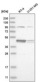 DSCC1 Antibody in Western Blot (WB)