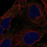 DENND3 Polyclonal Antibody