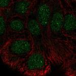 STK35 Polyclonal Antibody