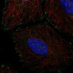 EMC4 Polyclonal Antibody