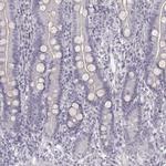 Cytokeratin 26 Polyclonal Antibody