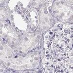IMPG1 Antibody in Immunohistochemistry (IHC)