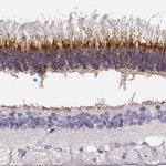 IMPG1 Polyclonal Antibody