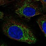 NAGS Polyclonal Antibody