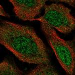 VPS13D Polyclonal Antibody