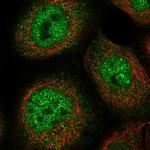 ZNF187 Polyclonal Antibody