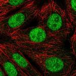 RNF220 Polyclonal Antibody