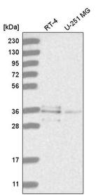 RNF220 Antibody in Western Blot (WB)