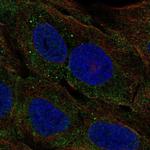 ELA3A Polyclonal Antibody