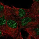 DUSP23 Polyclonal Antibody