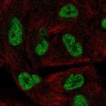 HORMAD1 Polyclonal Antibody