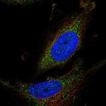 ATPAF1 Polyclonal Antibody