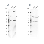 USP1 Antibody in Western Blot (WB)