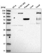 EPB41 Antibody in Western Blot (WB)