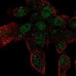 ZNF232 Polyclonal Antibody