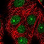 MAD2L1BP Polyclonal Antibody