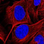 GRK4 Polyclonal Antibody