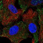 HTR1B Polyclonal Antibody