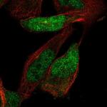 ZNF518A Polyclonal Antibody