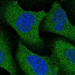 NRBP2 Polyclonal Antibody