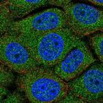 TMEM254 Polyclonal Antibody