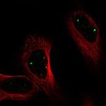 PRDM15 Antibody in Immunocytochemistry (ICC/IF)