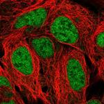 TAF11 Antibody in Immunocytochemistry (ICC/IF)