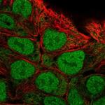 Calpain 13 Polyclonal Antibody