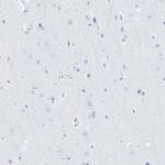 LALBA Antibody in Immunohistochemistry (Paraffin) (IHC (P))