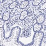 LALBA Antibody in Immunohistochemistry (Paraffin) (IHC (P))