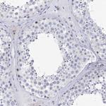LALBA Antibody in Immunohistochemistry (Paraffin) (IHC (P))