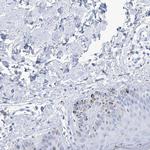 LALBA Antibody in Immunohistochemistry (IHC)