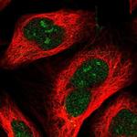 RRP36 Polyclonal Antibody