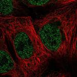 C21orf7 Polyclonal Antibody