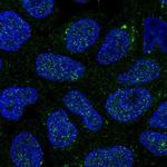 GALNT14 Polyclonal Antibody