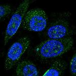 ZNF586 Polyclonal Antibody