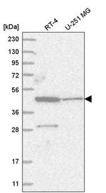 ZNF586 Antibody in Western Blot (WB)