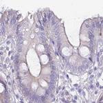 IMPG1 Antibody in Immunohistochemistry (IHC)