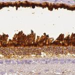 IMPG1 Polyclonal Antibody