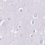 IMPG1 Antibody in Immunohistochemistry (IHC)